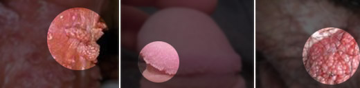 ���Լ���ʪ��֢״