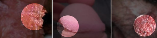 ���Լ���ʪ��֢״