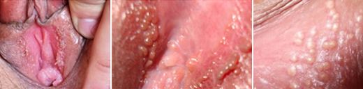 Ů�Լ���ʪ��֢״