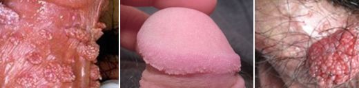 ���Լ���ʪ��֢״