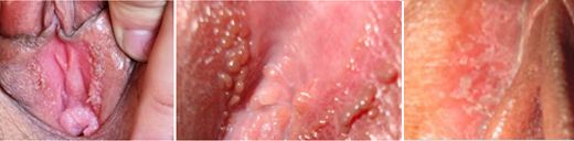 Ů����ֳ������֢״